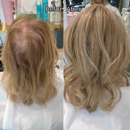 ⚡⚡ Final Hours –🌷2026 New Lightweight & Breathable Wavy Hair Topper